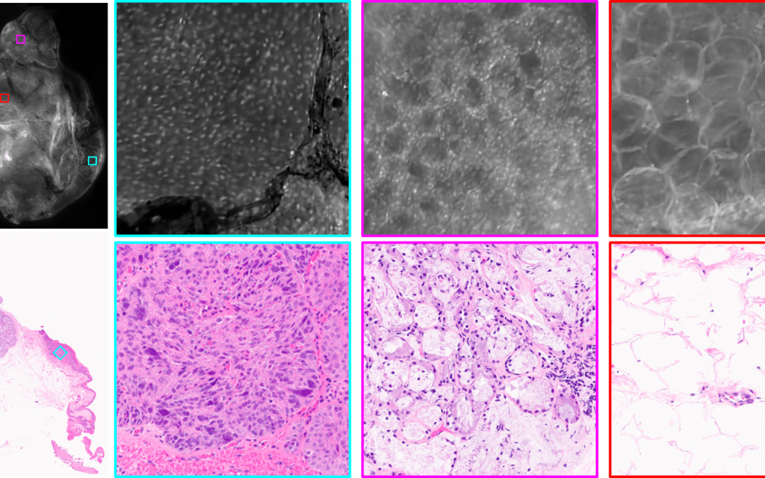 Deep learning extended depth-of-field microscope for fast and slide-free histology