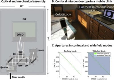 In vivo imaging of cervical precancer using a low-cost and easy-to-use confocal microendoscope